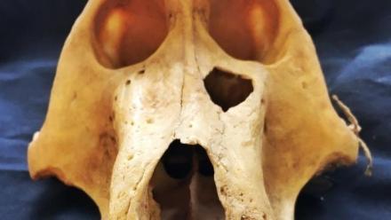 Chewing it over: Why what (and how) we eat has shaped primate and human evolution