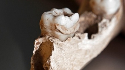 Ancient microbial DNA in dental calculus: a promising tool for studying past human movements